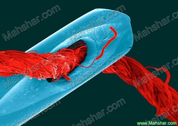 تصویری بی نظیر از گذر نخ از سوراخ سوزن